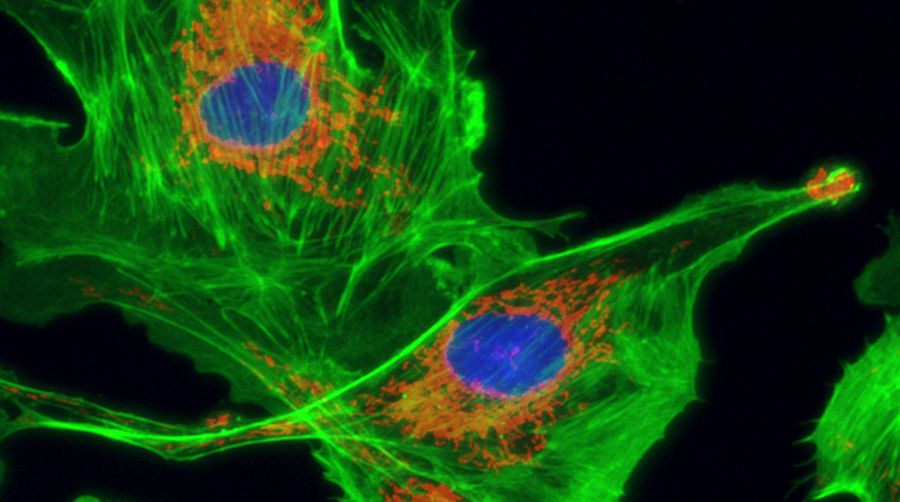 濾光片的作用 濾光片的作用