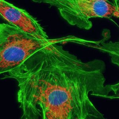 怎么提高顯微鏡的熒光成像的質量？